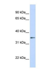 NBP1-55308 - Transducin beta chain 1 / GNB1