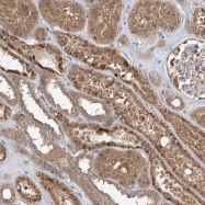 NBP1-81786 - WDR14 / GNB1L
