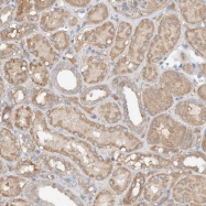 NBP1-81787 - WDR14 / GNB1L