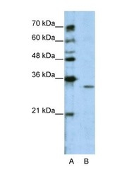 NBP1-58342 - WDR14 / GNB1L