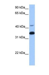 NBP1-55323 - Transducin beta chain 2 / GNB2