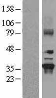 NBL1-11165 - GNB2 Lysate