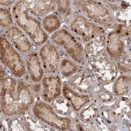 NBP1-81836 - GPCPD1 / GDE5