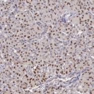 NBP1-90008 - Beta-ARK-2 / ADRBK2