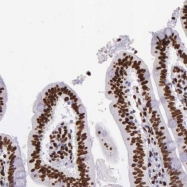 NBP1-83308 - Histone H1.0