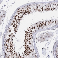 NBP1-86265 - Histone H1oo / H1FOO