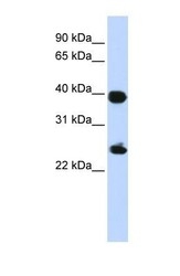 NBP1-53002 - H2AFY / MACROH2A1