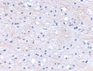 NBP1-77322 - Brain link protein 1 / BRAL1