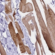 NBP1-91977 - Brain link protein 1 / BRAL1