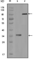 NBP1-47514 - HCK