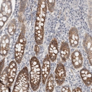 NBP1-81402 - HCN3