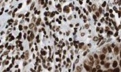 NBP1-78101 - HDAC1