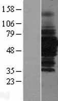 NBL1-11477 - HDAC1 Lysate
