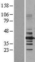 NBL1-11479 - HDAC11 Lysate