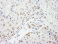 NB100-79798 - HDAC3