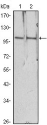 NBP1-51594 - HDAC4