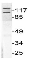 NB100-91803 - HDAC5