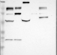 NBP1-85065 - HDAC7