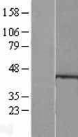 NBL1-11485 - HDAC8 Lysate