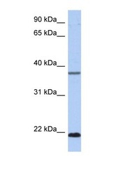 NBP1-56806 - HDDC3