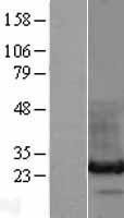 NBL1-11490 - HDGFRP3 Lysate