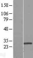 NBL1-11493 - HDHD3 Lysate