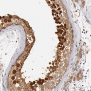 NBP1-88019 - DNAJA1 / HDJ2