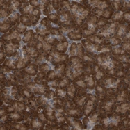NBP1-81065 - HEATR4