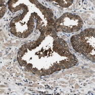 NBP1-86747 - Heme-binding protein 2 / HEBP2