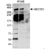 NBP1-49926 - HECTD1