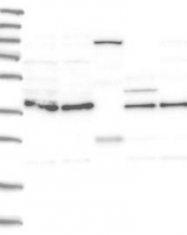 NBP1-81019 - HEMK1