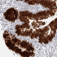 NBP1-88329 - HENMT1 / C1orf59