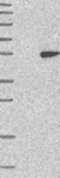 NBP1-88328 - HENMT1 / C1orf59