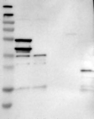 NBP1-83558 - hepaCAM