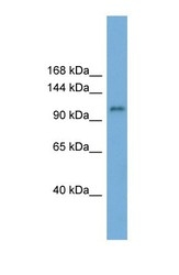 NBP1-55025 - HERC6