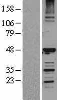 NBL1-11508 - HERPUD1 Lysate