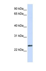 NBP1-60024 - ERVWE1