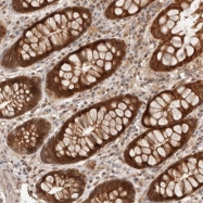 NBP1-83573 - Hexosaminidase D