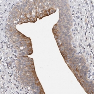 NBP1-83575 - Hexosaminidase D