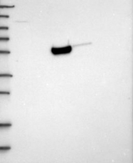 NBP1-83573 - Hexosaminidase D