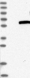 NBP1-83574 - Hexosaminidase D