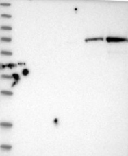 NBP1-83575 - Hexosaminidase D
