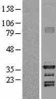 NBL1-11520 - HEY1 Lysate