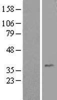 NBL1-11521 - HEY1 Lysate
