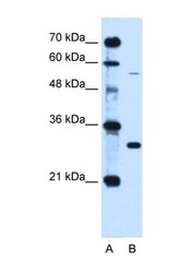 NBP1-59055 - HFE / HLAH