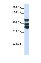 NBP1-55134 - Homogentisicase / HGD