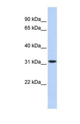 NBP1-54786 - HIBADH