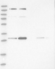 NBP1-82526 - HIBADH