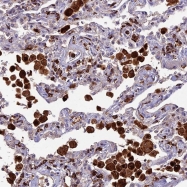 NBP1-80607 - HIC1 / ZBTB29