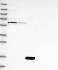 NBP1-81710 - HIC2 / ZBTB30
